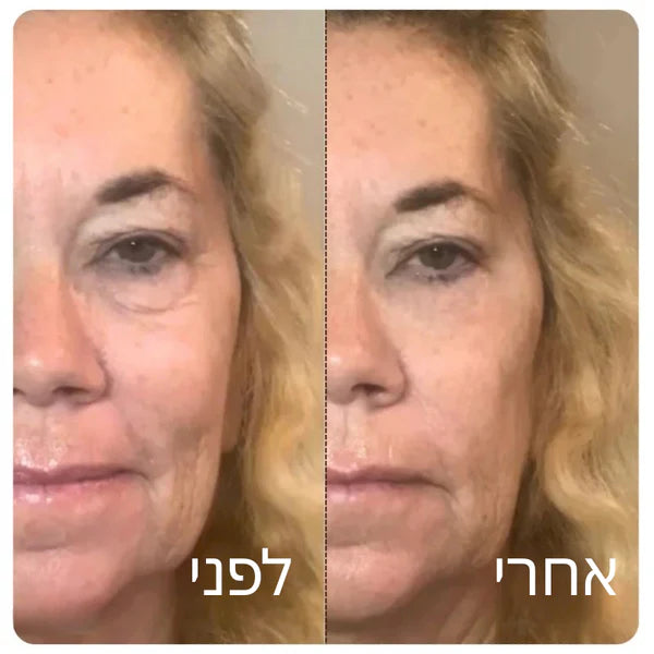 Patchiv™ אמפולת קולגן משי קוריאני