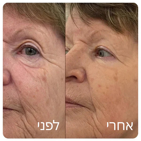 Patchiv™ אמפולת קולגן משי קוריאני