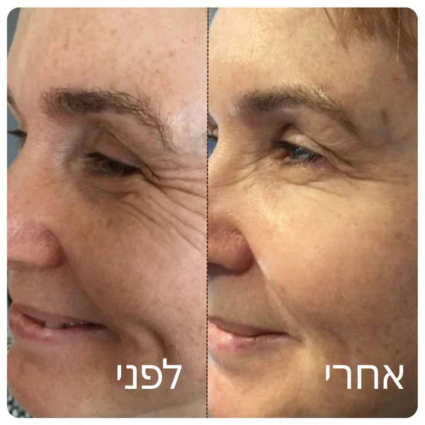 Patchiv™ אמפולת קולגן משי קוריאני