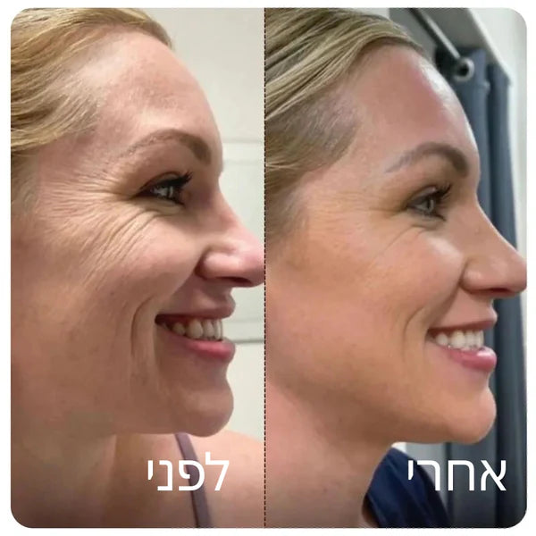 Patchiv™ אמפולת קולגן משי קוריאני