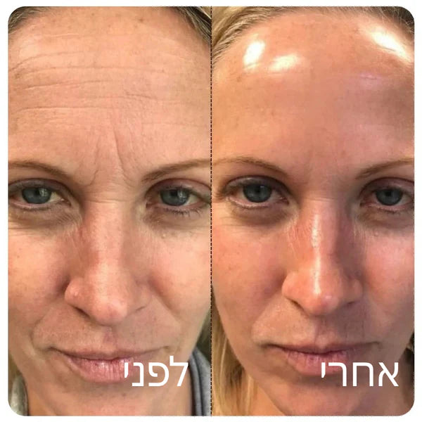 Patchiv™ אמפולת קולגן משי קוריאני