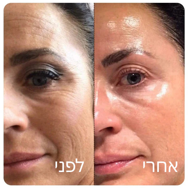 Patchiv™ אמפולת קולגן משי קוריאני